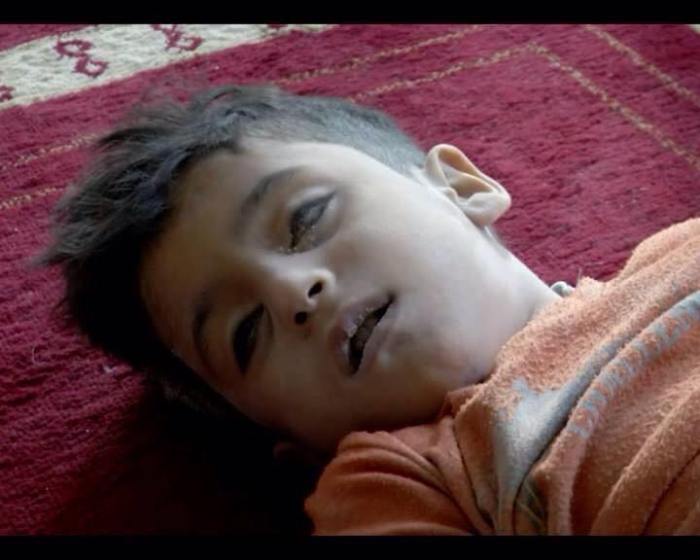 Child massacred by Saudi air raids on Sanaa, Yemen