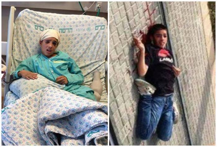 13 year old Ahmad Manasrah told to die, now chained to a hospital bed and forced to confess to a crime he did not commit.